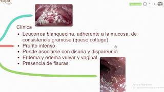 Candidiasis Vaginal Signos y síntomas  Diagnóstico  Tratamiento [upl. by Atiram]