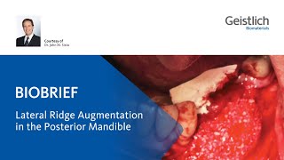 Lateral Ridge Augmentation in the posterior Mandible [upl. by Naylor]