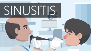 What is Sinusitis [upl. by Pollie]