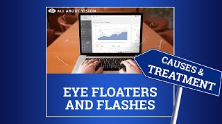 Eye Floaters Explained [upl. by Pederson]