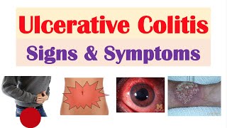 7 Eye Symptoms and What They Could Mean  Health [upl. by Nirel870]