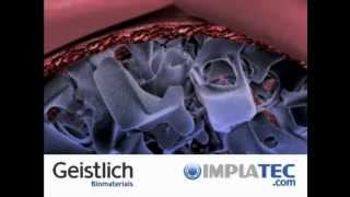 Guided Bone Regeneration with Geistlich Biomaterials [upl. by Retswerb]