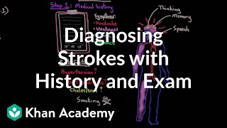 Diagnosing strokes by history and physical exam  NCLEXRN  Khan Academy [upl. by Og]